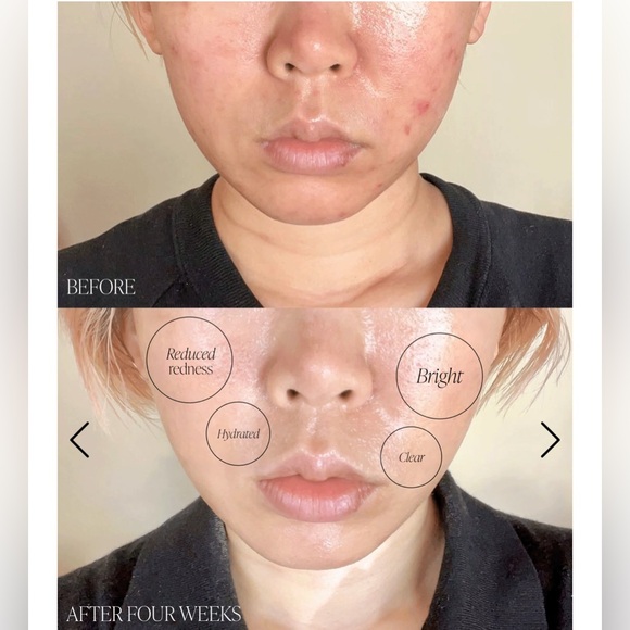 Byroe Basil Dark Spot Correcting Cream - Picture 5 of 11